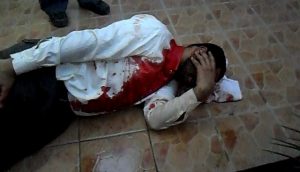 Injured protestor, Manama, 14 February 2011