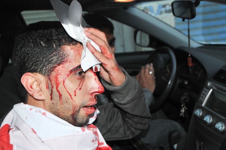 Injured demonstrator in Manama, 16 February 2011