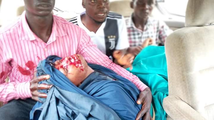 Nigeria: At least one fatality as security forces fire at peaceful demo in Abuja