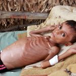 Alert: Yemen needs urgent humanitarian support!
